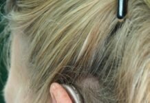Cómo funcionan los audífonos para la hipoacusia